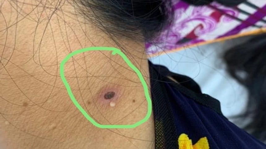 Bỏ sót khi kiểm tra sức khỏe