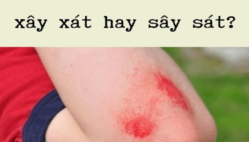 Ví dụ cụ thể sử dụng từ “sây sát” trong thực tế
