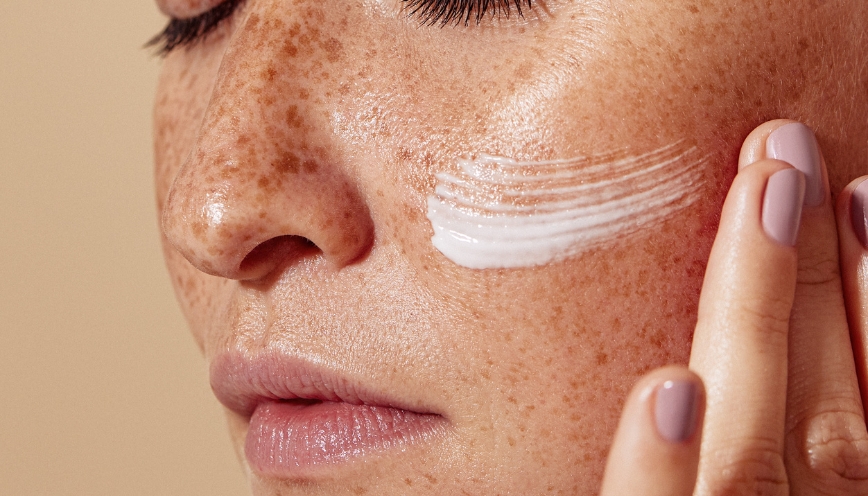 Hydroquinone được sử dụng để điều trị nám da
